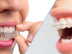 Exceptionnel : Poste Formation en Orthodontie H/F
