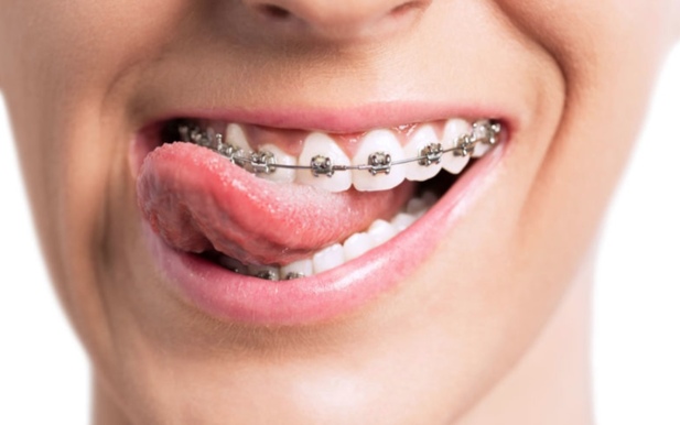 Opportunité Rare en Orthodontie H/F
