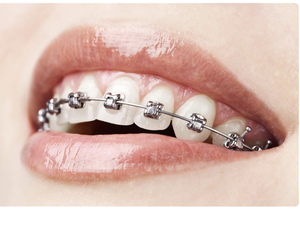 Cabinet d’orthodontie recherche collaboratrice (h/f)