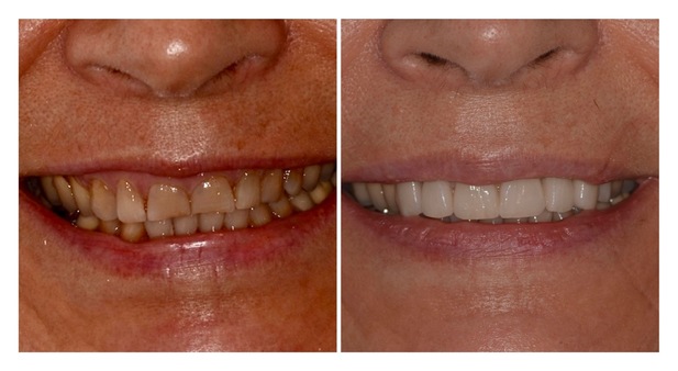 Cabinet Lyon centre cherche assistante dentaire H/F