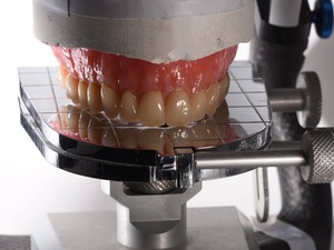 Recherche Assistante dentaire qualifiée ou en formation  H/F