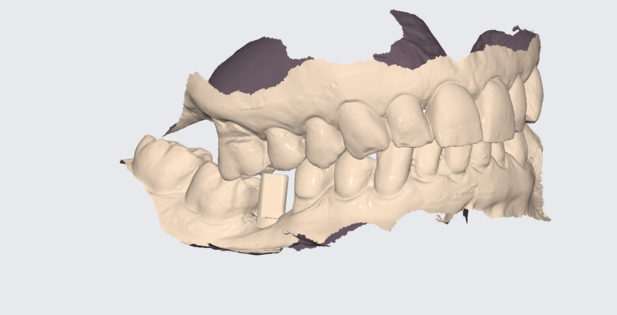 Recherche de collaboration salariée - expérience clinique et formation post-universitaire en endodontie, prothèses et parodontie.