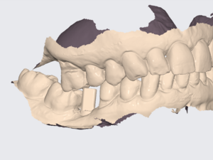 Recherche de collaboration salariée - expérience clinique et formation post-universitaire en endodontie, prothèses et parodontie.