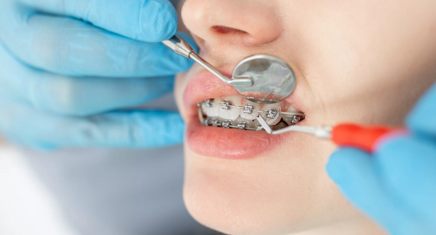 Assistante en orthodontie  H/F