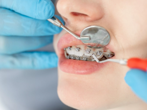Assistante en orthodontie  H/F
