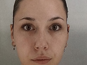 Alternance assistante dentaire 