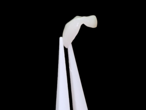 Prothésiste Dentaire polyvalent (Conjointe, Adjointe, Implantologie, Numérique)