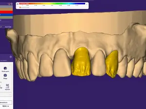 Prothesiste en CFAO Freelancer