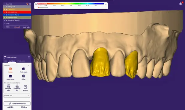 Prothesiste en CFAO Freelancer