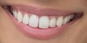 Remplacement omnipraticien 