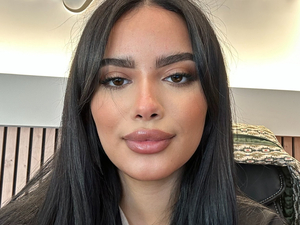 Assisstante dentaire en alternance 