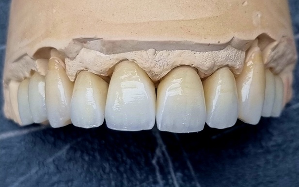 Auto entrepreneur Céramiste 