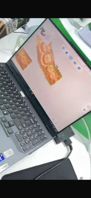 Caméra intra oral Rixi