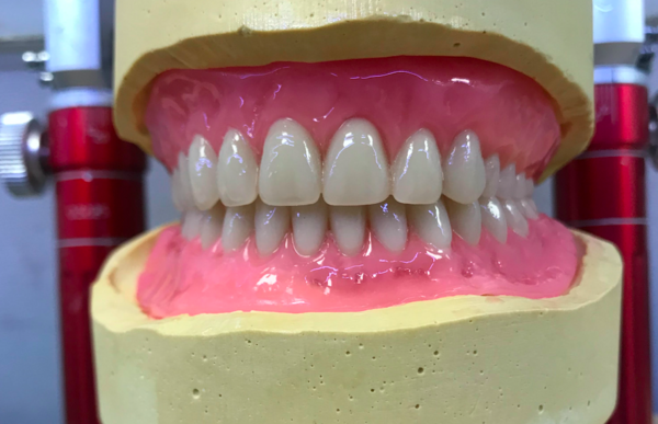 spécialiste en prothèse adjointe