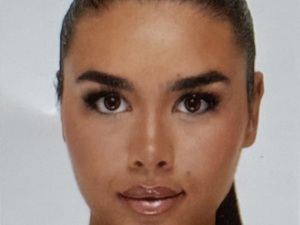 Assistante Dentaire en Alternance 