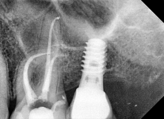 Recherche ENDODNTISTE spécialisé H/F