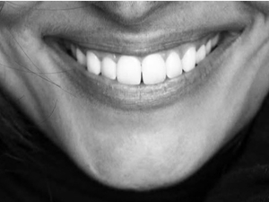 Remplacement juillet-août 2026 