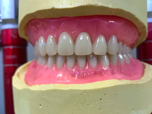 Prothésiste dentaire 