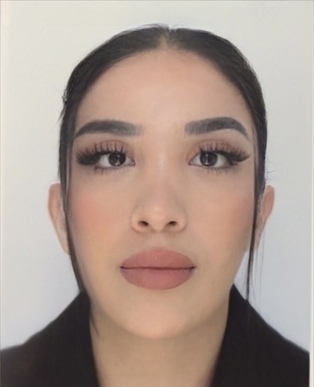 Assistante dentaire en alternance 