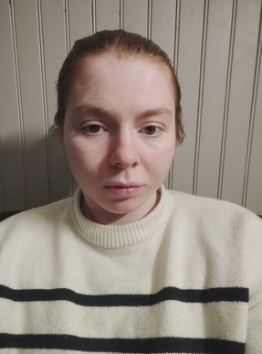 assistante dentaire en contrat de professionnalisation / alternance (28 ans)