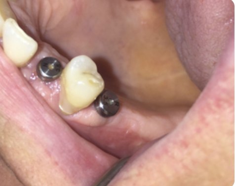 Chir DDS implanto dispo dès septembre