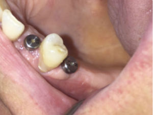 Chir DDS implanto dispo dès septembre