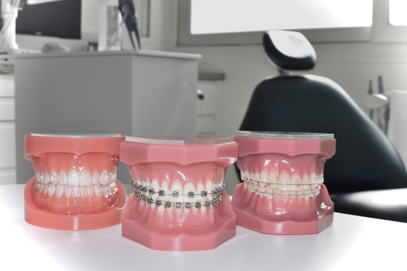 Recherche Assistant(e) Dentaire Polyvalent(e) H/F - CDI - Cabinet d'orthodontie Taverny (95)