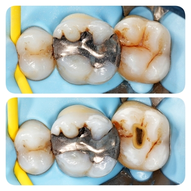 Vacations en Endodontie Exclusive – Haute-Savoie (74)