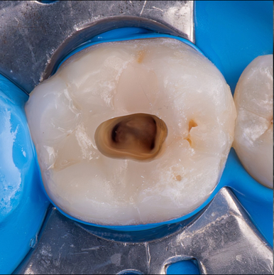 Collaboration libérale Endodontiste exclusif / Exercice Omnipratique mixte