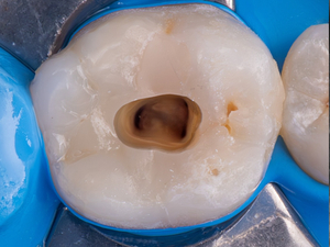 Collaboration libérale Endodontiste exclusif / Exercice Omnipratique mixte
