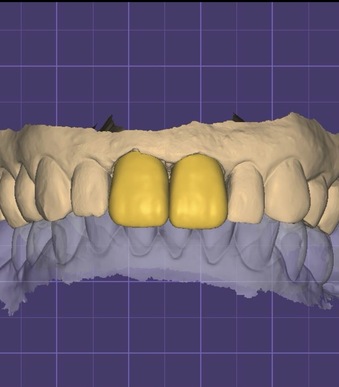 Recherche de collaboration salariée - expérience clinique et formation post-universitaire en endodontie, prothèses et parodontie.