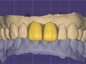 Recherche de collaboration salariée - expérience clinique et formation post-universitaire en endodontie, prothèses et parodontie.