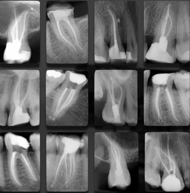 Vacations en Endodontie Exclusive H/F