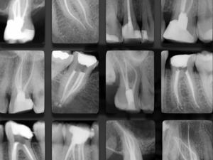 Vacations en Endodontie Exclusive H/F