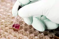 Le portefeuille des entreprises cotées a profité de la reprise dans le secteur biotechnologique. 