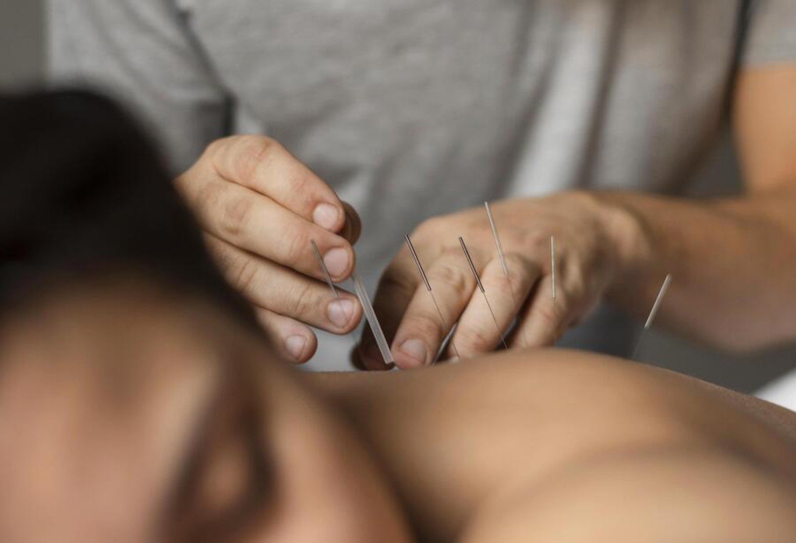 L’acupuncteur auto-entrepreneur