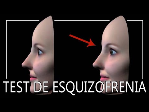 Identifica tu nivel de agresividad con este test