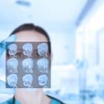 Tumores cerebrales en niños