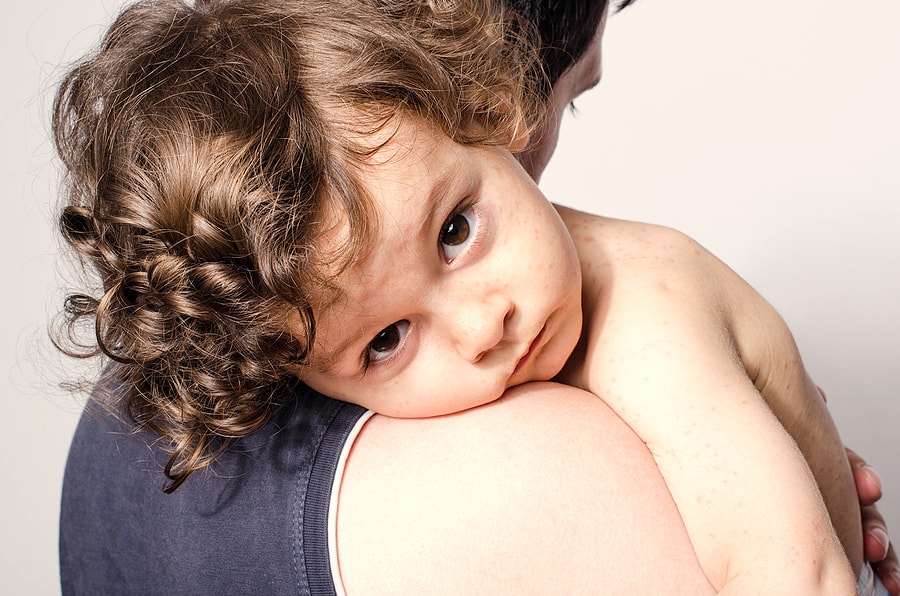 Exantemas víricos en niños