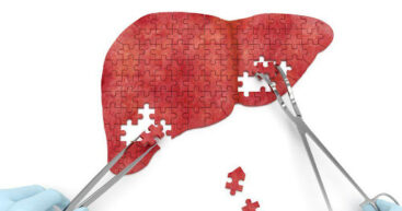 Всемирный день борьбы с гепатитом: в 2024 году зарегистрировано почти 3 000 случаев заболевания