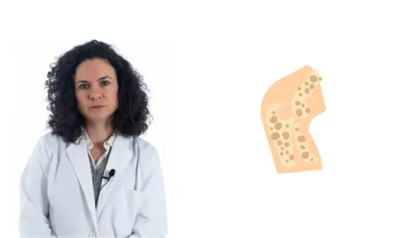 Osteoporosis