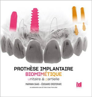 Prothèse implantaire biomimétique : unitaire & partielle