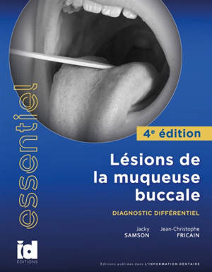 Lésions de la muqueuse buccale : diagnostic différentiel