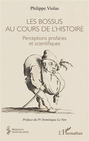 Les bossus au cours de l'histoire : perceptions profanes et scientifiques