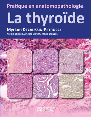 La thyroïde