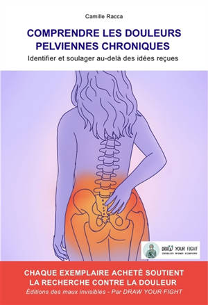 Comprendre les douleurs pelviennes chroniques