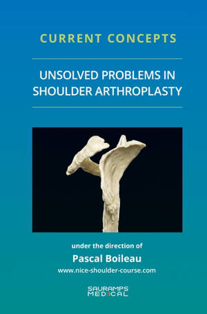 Unsolved problems in shoulder arthroplasty : current concepts