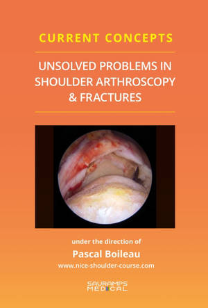 Unsolved problems in shoulder arthroscopy & fractures : current concepts