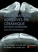 Restaurations adhésives en céramique : sur dents antérieures : approche biomimétique