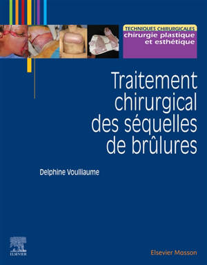 Traitement chirurgical des séquelles de brûlures